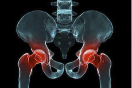 Crearán nicolaitas prótesis de huesos con material biomédico