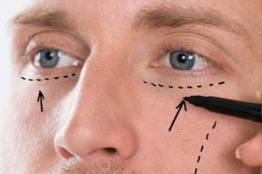 Servicios de alta calidad y a costos accesibles ofrece la Nueva Universidad a la población con respecto a la oculoplástica, a través del CIDOCS