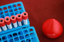 Examen médico de la UAA incorpora Química Sanguínea de 6 elementos para detección temprana de insuficiencia renal  