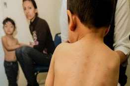 Estiman que hasta dos millones de personas tienen alguna alergia en Jalisco