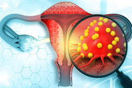 Seguir estrategia de la OMS para reducir el cáncer cervicouterino