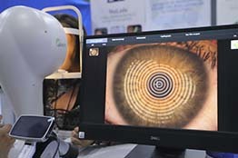 Día Mundial del Glaucoma, la Autónoma de Aguascalientes lleva a cabo una campaña de detección a precio accesible