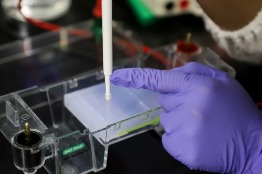 Investiga UAQ el bacterioma intestinal en mujeres con cáncer de mama